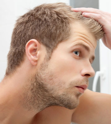 Can Low Testosterone Cause Hair Loss