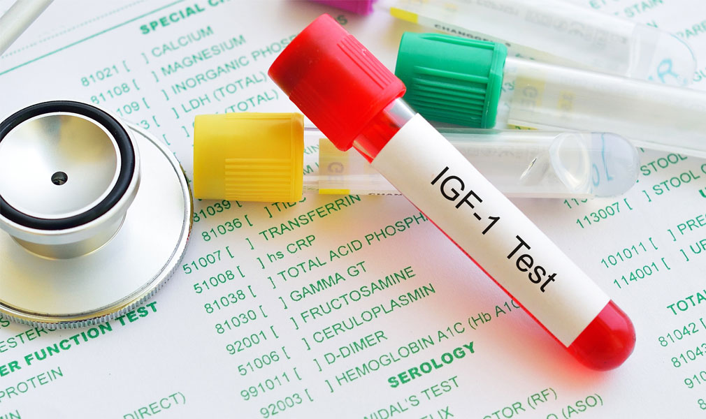 Testing Your Blood For IGF-1 Levels